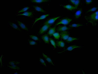Immunofluorescence staining of Hela Cells with CSB-RA204558A0HU at 1:50, counter-stained with DAPI. The cells were fixed in 4% formaldehyde, permeated by 0.2% TritonX-100, and blocked in 10% normal Goat Serum. The cells were then incubated with the antibody overnight at 4℃. Nuclear DNA was labeled in blue with DAPI. The secondary antibody was FITC-conjugated AffiniPure Goat Anti-Rabbit IgG (H+L) .