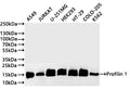 Western Blot
Positive WB detected in: A549 whole cell lysate(30µg) , JURKAT whole cell lysate(30µg) , U-251MG whole cell lysate(30µg) , HEK293 whole cell lysate(30µg) , HT-29 whole cell lysate(30µg) , COLO-205 whole cell lysate(30µg) ,K562 whole cell lysate(30µg) 
All lanes: Profilin 1 antibody at 1:1000
Secondary
Goat polyclonal to rabbit IgG at 1/40000 dilution
Predicted band size: 15 kDa
Observed band size: 15 kDa
Exposure time：2min