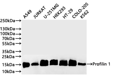 Western Blot
Positive WB detected in: A549 whole cell lysate(30µg) , JURKAT whole cell lysate(30µg) , U-251MG whole cell lysate(30µg) , HEK293 whole cell lysate(30µg) , HT-29 whole cell lysate(30µg) , COLO-205 whole cell lysate(30µg) ,K562 whole cell lysate(30µg) 
All lanes: Profilin 1 antibody at 1:1000
Secondary
Goat polyclonal to rabbit IgG at 1/40000 dilution
Predicted band size: 15 kDa
Observed band size: 15 kDa
Exposure time：2min