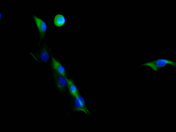 Immunofluorescence staining of NIH/3T3 cell with CSB-RA207310A0HU at 1:50 , counter-stained with DAPI. The cells were fixed in 4% formaldehyde, permeabilized using 0.2% Triton X-100 and blocked in 10% normal Goat Serum. The cells were then incubated with the antibody overnight at 4°C. The secondary antibody was Alexa Fluor 488-congugated AffiniPure Goat Anti-Rabbit IgG(H+L).