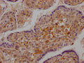 DDX58 Antibody – Figure 1 of 1