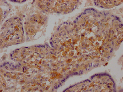 DDX58 Antibody – Figure 1 of 1
