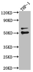 Western Blot
Positive WB detected in: A549 whole cell lysate, U-251 whole cell lysate, Hela whole cell lysate
All lanes: FLI1 antibody at 1:1000
Secondary
Goat polyclonal to rabbit IgG at 1/50000 dilution
Predicted band size: 51, 44, 48, 30 kDa
Observed band size: 51 kDa