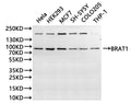 Western Blot
Positive WB detected in: Hela whole cell lysate(30µg), HEK293 whole cell lysate(30µg), MCF-7 whole cell lysate(30µg), SH-SY5Y whole cell lysate(30µg), COLO-205 whole cell lysate(30µg), THP-1 whole cell lysate(30µg)
All lanes: BRAT1 antibody at 1:1000
Secondary
Goat polyclonal to rabbit IgG at 1/40000 dilution
Predicted band size: 88 kDa
Observed band size: 88 kDa
Exposure time：1min