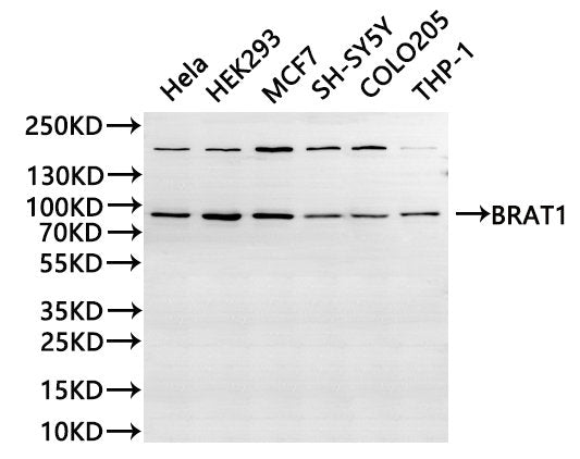 Western Blot
Positive WB detected in: Hela whole cell lysate(30µg), HEK293 whole cell lysate(30µg), MCF-7 whole cell lysate(30µg), SH-SY5Y whole cell lysate(30µg), COLO-205 whole cell lysate(30µg), THP-1 whole cell lysate(30µg)
All lanes: BRAT1 antibody at 1:1000
Secondary
Goat polyclonal to rabbit IgG at 1/40000 dilution
Predicted band size: 88 kDa
Observed band size: 88 kDa
Exposure time：1min