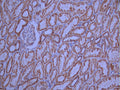 IHC image of CSB-RA208703A0HU diluted at 1:100 and staining in paraffin-embedded human kidney tissue performed on a Leica BondTM system. After dewaxing and hydration, antigen retrieval was mediated by high pressure in a citrate buffer (pH 6.0). Section was blocked with 10% normal goat serum 30min at RT. Then primary antibody (1% BSA) was incubated at 4°C overnight. The primary is detected by a Goat anti-rabbit polymer IgG labeled by HRP and visualized using 0.05% DAB.