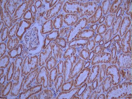 IHC image of CSB-RA208703A0HU diluted at 1:100 and staining in paraffin-embedded human kidney tissue performed on a Leica BondTM system. After dewaxing and hydration, antigen retrieval was mediated by high pressure in a citrate buffer (pH 6.0). Section was blocked with 10% normal goat serum 30min at RT. Then primary antibody (1% BSA) was incubated at 4°C overnight. The primary is detected by a Goat anti-rabbit polymer IgG labeled by HRP and visualized using 0.05% DAB.