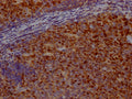 IHC image of CSB-RA209144A0HU diluted at 1:100 and staining in paraffin-embedded human tonsil tissue performed on a Leica BondTM system. After dewaxing and hydration, antigen retrieval was mediated by high pressure in a citrate buffer (pH 6.0) . Section was blocked with 10% normal goat serum 30min at RT. Then primary antibody (1% BSA) was incubated at 4℃ overnight. The primary is detected by a Goat anti-rabbit IgG polymer labeled by HRP and visualized using 0.05% DAB.