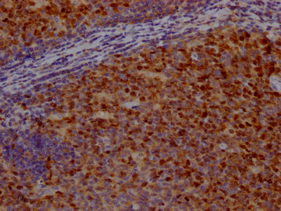 IHC image of CSB-RA209144A0HU diluted at 1:100 and staining in paraffin-embedded human tonsil tissue performed on a Leica BondTM system. After dewaxing and hydration, antigen retrieval was mediated by high pressure in a citrate buffer (pH 6.0) . Section was blocked with 10% normal goat serum 30min at RT. Then primary antibody (1% BSA) was incubated at 4℃ overnight. The primary is detected by a Goat anti-rabbit IgG polymer labeled by HRP and visualized using 0.05% DAB.