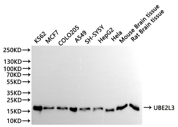 Western Blot
Positive WB detected in: K562 whole cell lysate(30µg), MCF-7 whole cell lysate(30µg), COLO-205 whole cell lysate(30µg), A549 whole cell lysate(30µg), SH-SY5Y whole cell lysate(30µg), HepG2 whole cell lysate(30µg), Hela whole cell lysate(30µg), Mouse brain tissue lysate(30µg), Rat brain tissue lysate(30µg)
All lanes:UBE2L3 antibody at 1:1000
Secondary
Goat polyclonal to rabbit IgG at 1/40000 dilution
Predicted band size: 18 kDa
Observed band size: 18 kDa
Exposure time：10s