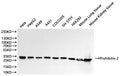 Western Blot, 
Positive WB detected in:Hela whole cell lysate(30µg), HepG2 whole cell lysate(30µg), A549 whole cell lysate(30µg), A431 whole cell lysate(30µg), COLO205 whole cell lysate(30µg), SH-SY5Y whole cell lysate(30µg), HEK293 whole cell lysate(30µg), Mouse lung tissue lysate(30µg), Mouse kidney lysate(30µg)
All lanes: Prohibitin 2 antibody at 1:1000
Secondary
Goat polyclonal to rabbit IgG at 1/40000 dilution
Predicted band size: 33 kDa
Observed band size: 33 kDa
Exposure time：5s