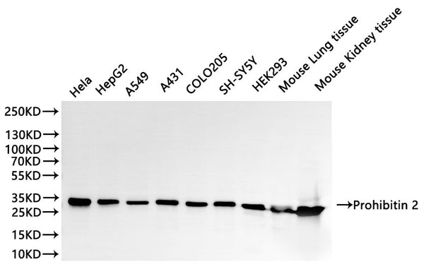Western Blot, 
Positive WB detected in:Hela whole cell lysate(30µg), HepG2 whole cell lysate(30µg), A549 whole cell lysate(30µg), A431 whole cell lysate(30µg), COLO205 whole cell lysate(30µg), SH-SY5Y whole cell lysate(30µg), HEK293 whole cell lysate(30µg), Mouse lung tissue lysate(30µg), Mouse kidney lysate(30µg)
All lanes: Prohibitin 2 antibody at 1:1000
Secondary
Goat polyclonal to rabbit IgG at 1/40000 dilution
Predicted band size: 33 kDa
Observed band size: 33 kDa
Exposure time：5s