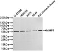 Western Blot
Positive WB detected in:  U-87MG whole cell lysate(30µg) , HEK293 whole cell lysate(30µg) , A375 whole cell lysate(30µg) , A549 whole cell lysate(30µg) , Rat stomach tissue lysate(30µg) 
All lanes: MMP1 antibody at 1:1000
Secondary
Goat polyclonal to rabbit IgG at 1/40000 dilution
Predicted band size: 54 kDa
Observed band size: 55 kDa
Exposure time：3min