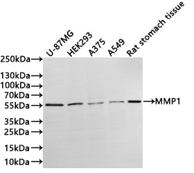 Western Blot
Positive WB detected in:  U-87MG whole cell lysate(30µg) , HEK293 whole cell lysate(30µg) , A375 whole cell lysate(30µg) , A549 whole cell lysate(30µg) , Rat stomach tissue lysate(30µg) 
All lanes: MMP1 antibody at 1:1000
Secondary
Goat polyclonal to rabbit IgG at 1/40000 dilution
Predicted band size: 54 kDa
Observed band size: 55 kDa
Exposure time：3min