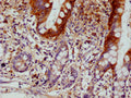IHC image of CSB-RA213020A0HU diluted at 1:100 and staining in paraffin-embedded human small intestine tissue performed on a Leica BondTM system. After dewaxing and hydration, antigen retrieval was mediated by high pressure in a citrate buffer (pH 6.0) . Section was blocked with 10% normal goat serum 30min at RT. Then primary antibody (1% BSA) was incubated at 4°C overnight. The primary is detected by a Goat anti-rabbit polymer IgG labeled by HRP and visualized using 0.05% DAB.
