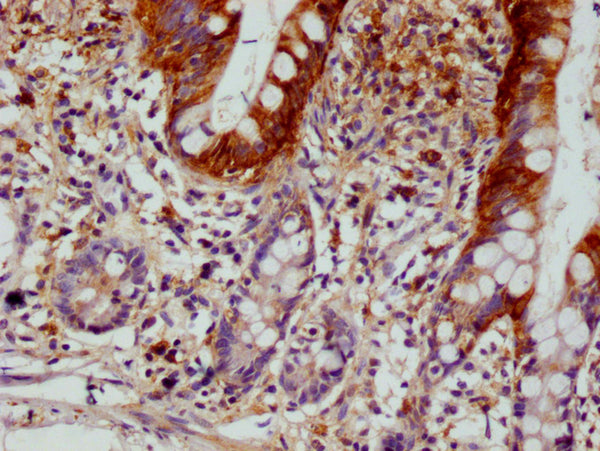 IHC image of CSB-RA213020A0HU diluted at 1:100 and staining in paraffin-embedded human small intestine tissue performed on a Leica BondTM system. After dewaxing and hydration, antigen retrieval was mediated by high pressure in a citrate buffer (pH 6.0) . Section was blocked with 10% normal goat serum 30min at RT. Then primary antibody (1% BSA) was incubated at 4°C overnight. The primary is detected by a Goat anti-rabbit polymer IgG labeled by HRP and visualized using 0.05% DAB.