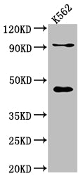 Western Blot
Positive WB detected in: K562 whole cell lysate
All lanes: PCYT1A antibody at 1:1000
Secondary
Goat polyclonal to rabbit IgG at 1/50000 dilution
Predicted band size: 42 kDa
Observed band size: 42 kDa