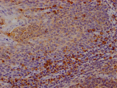 IHC image of CSB-RA213310A0HU diluted at 1:100 and staining in paraffin-embedded human tonsil tissue performed on a Leica BondTM system. After dewaxing and hydration, antigen retrieval was mediated by high pressure in a citrate buffer (pH 6.0) . Section was blocked with 10% normal goat serum 30min at RT. Then primary antibody (1% BSA) was incubated at 4℃ overnight. The primary is detected by a Goat anti-rabbit IgG polymer labeled by HRP and visualized using 0.05% DAB.
