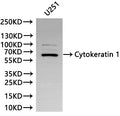 Western Blot, 
Positive WB detected in:U251 whole cell lysate(30µg)
All lanes: Cytokeratin 1 antibody at 1:1000
Secondary
Goat polyclonal to rabbit IgG at 1/40000 dilution
Predicted band size: 66 kDa
Observed band size: 66 kDa
Exposure time：180s