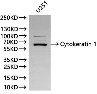 Western Blot, 
Positive WB detected in:U251 whole cell lysate(30µg)
All lanes: Cytokeratin 1 antibody at 1:1000
Secondary
Goat polyclonal to rabbit IgG at 1/40000 dilution
Predicted band size: 66 kDa
Observed band size: 66 kDa
Exposure time：180s