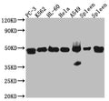 Western Blot
Positive WB detected in: PC-3 whole cell lysate, K562 whole cell lysate, HL-60 whole cell lysate, A549 whole cell lysate, Mouse Spleen whole cell lysate, Rat Spleen whole cell lysate
All lanes: Arp3 Antibody at 1:1000
Secondary
Goat polyclonal to rabbit IgG at 1/50000 dilution
Predicted band size: 48 kDa
Observed band size: 48 kDa