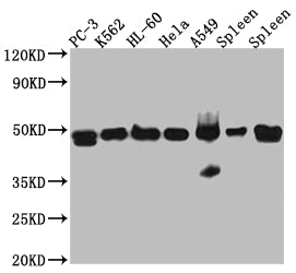Western Blot
Positive WB detected in: PC-3 whole cell lysate, K562 whole cell lysate, HL-60 whole cell lysate, A549 whole cell lysate, Mouse Spleen whole cell lysate, Rat Spleen whole cell lysate
All lanes: Arp3 Antibody at 1:1000
Secondary
Goat polyclonal to rabbit IgG at 1/50000 dilution
Predicted band size: 48 kDa
Observed band size: 48 kDa