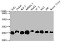Western Blot
Positive WB detected in: Hela whole cell lysate, Jurkat whole cell lysate, MCF-7 whole cell lysate, RAW264.7 whole cell lysate, HepG2 whole cell lysate, PC-3 whole cell lysate, Raji whole cell lysate, 293 whole cell lysate, Mouse liver tissue
All lanes: TPT1 antibody at 1:2000
Secondary
Goat polyclonal to rabbit IgG at 1/50000 dilution
Predicted band size: 20, 16 kDa
Observed band size: 25 kDa