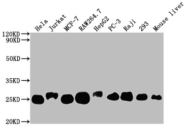 Western Blot
Positive WB detected in: Hela whole cell lysate, Jurkat whole cell lysate, MCF-7 whole cell lysate, RAW264.7 whole cell lysate, HepG2 whole cell lysate, PC-3 whole cell lysate, Raji whole cell lysate, 293 whole cell lysate, Mouse liver tissue
All lanes: TPT1 antibody at 1:2000
Secondary
Goat polyclonal to rabbit IgG at 1/50000 dilution
Predicted band size: 20, 16 kDa
Observed band size: 25 kDa