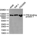 Western Blot
Positive WB detected in: A549 whole cell lysate(30µg), THP-1 whole cell lysate(30µg), COLO205 whole cell lysate(30µg)
All lanes: FYN binding protein 1 antibody at 1:1000
Secondary
Goat polyclonal to rabbit IgG at 1/40000 dilution
Predicted band size: 85 kDa
Observed band size: 120 kDa
Exposure time：2min