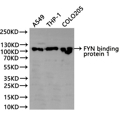 Western Blot
Positive WB detected in: A549 whole cell lysate(30µg), THP-1 whole cell lysate(30µg), COLO205 whole cell lysate(30µg)
All lanes: FYN binding protein 1 antibody at 1:1000
Secondary
Goat polyclonal to rabbit IgG at 1/40000 dilution
Predicted band size: 85 kDa
Observed band size: 120 kDa
Exposure time：2min