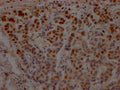 TP53 Antibody – Figure 1 of 1