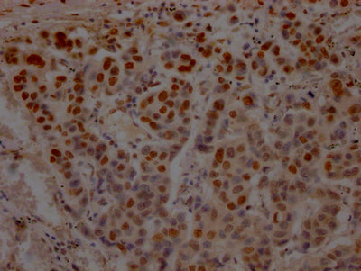 TP53 Antibody – Figure 1 of 1