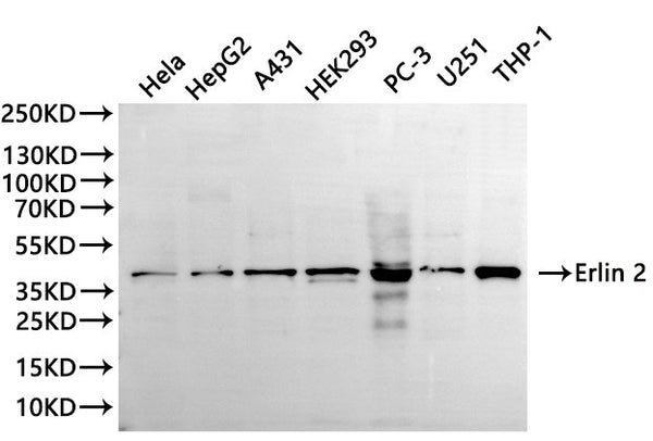 Western Blot, 
Positive WB detected in:Hela whole cell lysate(30µg), HepG2 whole cell lysate(30µg), A431 whole cell lysate(30µg), HEK293 whole cell lysate(30µg), PC-3 whole cell lysate(30µg), U251 whole cell lysate(30µg), THP-1 whole cell lysate(30µg)
All lanes: Erlin 2 antibody at 1:1000
Secondary
Goat polyclonal to rabbit IgG at 1/40000 dilution
Predicted band size: 38 kDa
Observed band size: 38 kDa
Exposure time：120s