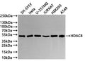 Western Blot
Positive WB detected in: SH-SY5Y whole cell lysate(20µg) , Hela whole cell lysate(20µg) , U-251MG whole cell lysate(20µg) , JURKAT whole cell lysate(20µg) , HEK293 whole cell lysate(20µg) ,A549 whole cell lysate(20µg) , Mouse liver tissue lysate(20µg) 
All lanes: HDAC8 antibody at 1:1000
Secondary
Goat polyclonal to rabbit IgG at 1/40000 dilution
Predicted band size: 42 kDa
Observed band size: 45 kDa
Exposure time：1min