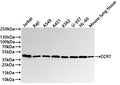 Western Blot
Positive WB detected in:  Jurkat whole cell lysate(30µg) , Raji whole cell lysate(30µg) , A549 whole cell lysate(30µg) , A431 whole cell lysate(30µg) , K562 whole cell lysate(30µg) , U-937 whole cell lysate(30µg) , HL-60 whole cell lysate(30µg) , Mouse lung tissue lysate(30µg) 
All lanes: CCR7  antibody at 1:1000
Secondary
Goat polyclonal to rabbit IgG at 1/40000 dilution
Predicted band size: 43 kDa
Observed band size: 43 kDa
Exposure time：20s