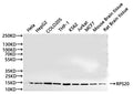 Western Blot, 
Positive WB detected in:Hela whole cell lysate(30µg), HepG2 whole cell lysate(30µg), COLO205 whole cell lysate(30µg), THP-1 whole cell lysate(30µg), K562 whole cell lysate(30µg), Jurkat whole cell lysate(30µg), MCF7 whole cell lysate(30µg), Mouse brainr tissue lysate(30µg), Rat brain lysate(30µg)
All lanes: RPS20 antibody at 1:1000
Secondary
Goat polyclonal to rabbit IgG at 1/40000 dilution
Predicted band size: 13 kDa
Observed band size: 13 kDa
Exposure time：60s