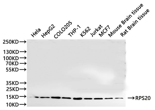 Western Blot, 
Positive WB detected in:Hela whole cell lysate(30µg), HepG2 whole cell lysate(30µg), COLO205 whole cell lysate(30µg), THP-1 whole cell lysate(30µg), K562 whole cell lysate(30µg), Jurkat whole cell lysate(30µg), MCF7 whole cell lysate(30µg), Mouse brainr tissue lysate(30µg), Rat brain lysate(30µg)
All lanes: RPS20 antibody at 1:1000
Secondary
Goat polyclonal to rabbit IgG at 1/40000 dilution
Predicted band size: 13 kDa
Observed band size: 13 kDa
Exposure time：60s