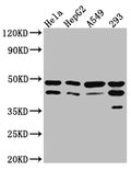Western Blot
Positive WB detected in: Hela whole cell lysate, HepG2 whole cell lysate, A549 whole cell lysate, 293 whole cell lysate
All lanes: GSK3 beta Antibody at 1:1000
Secondary
Goat polyclonal to rabbit IgG at 1/50000 dilution
Predicted band size: 47, 49 kDa
Observed band size: 47 kDa