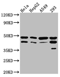 Western Blot
Positive WB detected in: Hela whole cell lysate, HepG2 whole cell lysate, A549 whole cell lysate, 293 whole cell lysate
All lanes: GSK3 beta Antibody at 1:1000
Secondary
Goat polyclonal to rabbit IgG at 1/50000 dilution
Predicted band size: 47, 49 kDa
Observed band size: 47 kDa