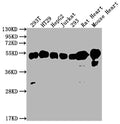 Western Blot
Positive WB detected in: 293T whole cell lysate, HT29 whole cell lysate, HepG2 whole cell lysate, Jurkat whole cell lysate, 293 whole cell lysate, Rat Heart tissue, Mouse Heart tissue
All lanes: ATP5F1B antibody at 1:2000
Secondary
Goat polyclonal to rabbit IgG at 1/50000 dilution
Predicted band size: 57 kDa
Observed band size: 57 kDa