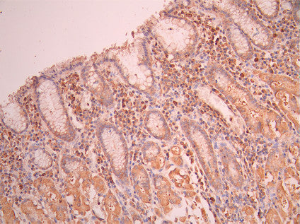 IHC image of CSB-RA216952A0HU diluted at 1:100 and staining in paraffin-embedded human stomach tissue performed on a Leica BondTM system. After dewaxing and hydration, antigen retrieval was mediated by high pressure in a citrate buffer (pH 6.0). Section was blocked with 10% normal goat serum 30min at RT. Then primary antibody (1% BSA) was incubated at 4°C overnight. The primary is detected by a Goat anti-rabbit polymer IgG labeled by HRP and visualized using 0.05% DAB.
