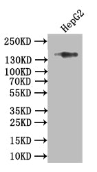 Western Blot
Positive WB detected in: HEPG2 whole cell lysate
All lanes: Collagen XVII antibody at 1:1000
Secondary
Goat polyclonal to rabbit IgG at 1/50000 dilution
Predicted band size: 150 kDa
Observed band size: 150 kDa