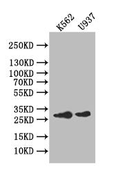 Western Blot
Positive WB detected in: K562 whole cell lysate,U937 whole cell lysate
All lanes: Ikaros antibody at 1:1000
Secondary
Goat polyclonal to rabbit IgG at 1/50000 dilution
Predicted band size: 28 kDa
Observed band size: 28 kDa