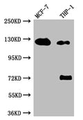 Western BlotPositive WB detected in: MCF-7 whole cell lysate, THP-1 whole cell lysateAll lanes: Androgen Receptor antibody at 1:1000SecondaryGoat polyclonal to rabbit IgG at 1/50000 dilutionPredicted band size: 100, 45, 68, kDaObserved band size: 125 kDa