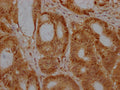 EZH2 Antibody – Figure 1 of 1