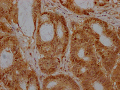 EZH2 Antibody – Figure 1 of 1