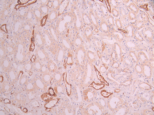 IHC image of CSB-RA218172A0HU diluted at 1:100 and staining in paraffin-embedded human kidney tissue performed on a Leica BondTM system. After dewaxing and hydration, antigen retrieval was mediated by high pressure in a citrate buffer (pH 6.0) . Section was blocked with 10% normal goat serum 30min at RT. Then primary antibody (1% BSA) was incubated at 4°C overnight. The primary is detected by a Goat anti-rabbit polymer IgG labeled by HRP and visualized using 0.05% DAB.
