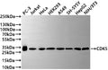 Western Blot
Positive WB detected in: PC-3 whole cell lysate(30µg) , Jurkat whole cell lysate(30µg) , HeLa whole cell lysate(30µg) , HEK293 whole cell lysate(30µg) , A549 whole cell lysate(30µg) , SH-SY5Y whole cell lysate(30µg) , HepG2 whole cell lysate(30µg) , NIH/3T3 whole cell lysate(30µg) 
All lanes: CDK5 antibody at 1:1000
Secondary
Goat polyclonal to rabbit IgG at 1/50000 dilution
Predicted band size: 35 kDa
Observed band size: 33 kDa
Exposure time: 2min