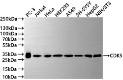 Western Blot
Positive WB detected in: PC-3 whole cell lysate(30µg) , Jurkat whole cell lysate(30µg) , HeLa whole cell lysate(30µg) , HEK293 whole cell lysate(30µg) , A549 whole cell lysate(30µg) , SH-SY5Y whole cell lysate(30µg) , HepG2 whole cell lysate(30µg) , NIH/3T3 whole cell lysate(30µg) 
All lanes: CDK5 antibody at 1:1000
Secondary
Goat polyclonal to rabbit IgG at 1/50000 dilution
Predicted band size: 35 kDa
Observed band size: 33 kDa
Exposure time: 2min
