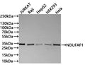 Western Blot
Positive WB detected in: Jurkat whole cell lysate(30µg) , Raji whole cell lysate(30µg) , HepG2 whole cell lysate(30µg) , HEK293 whole cell lysate(30µg) , Hela whole cell lysate(30µg) 
All lanes: NDUFAF1 antibody at 1:1000
Secondary
Goat polyclonal to rabbit IgG at 1/40000 dilution
Predicted band size: 38 kDa
Observed band size: 33 kDa
Exposure time：1min
